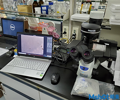 明美新款顯微鏡相機助力深圳市第三人民醫院肝病研究所活細胞檢測
