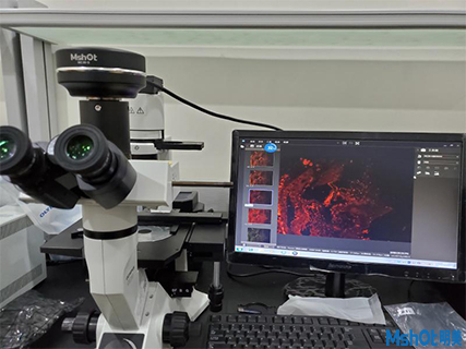 明美顯微鏡相機力香港大學深圳醫院熒光組織切片觀察
