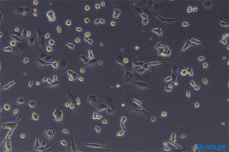 倒置顯微鏡應用于小鼠細胞株觀察