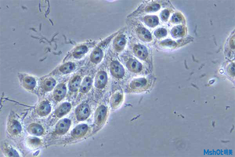 倒置顯微鏡應用于細胞株培養