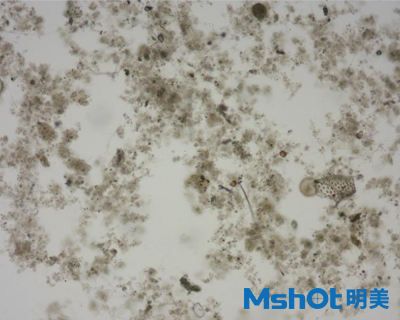 微擬球藻采用什么顯微鏡觀察？