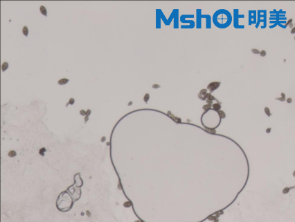 不同顯微鏡下的真菌孢子
