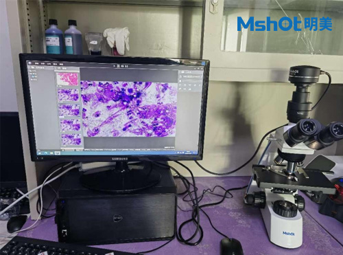 國產生物顯微鏡用于觀察中性粒細胞