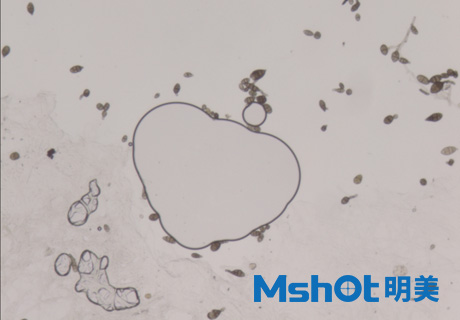 真菌檢測一般配備什么顯微鏡？