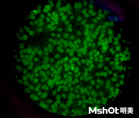 熒光生物顯微鏡應用于ANA-HEp2免疫熒光診斷
